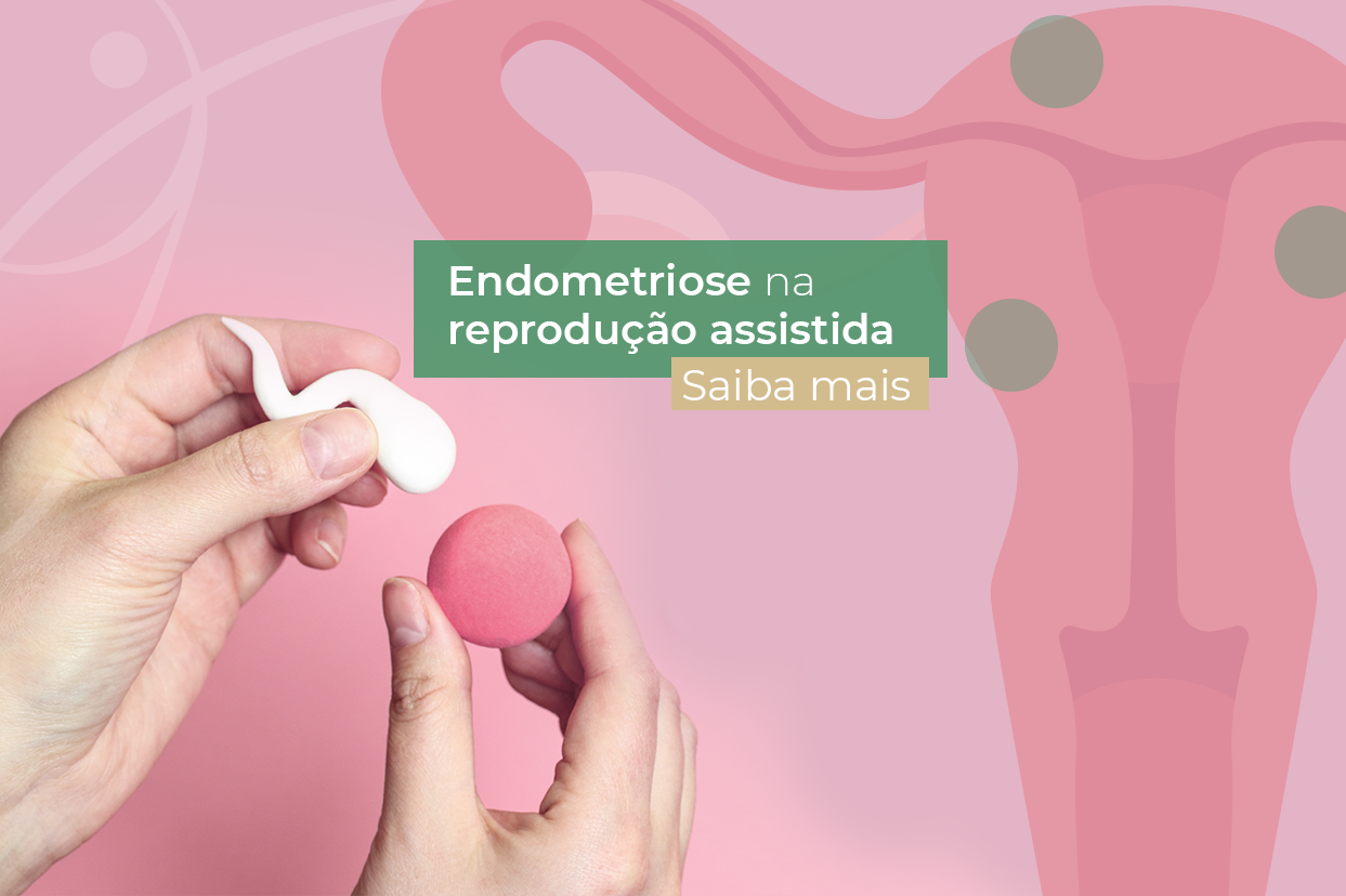 Endometriose e menstruação