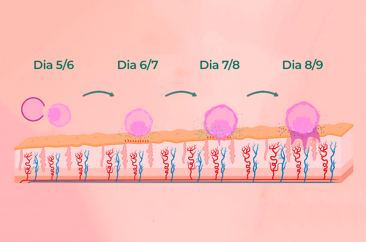 Nidação ou menstruação??